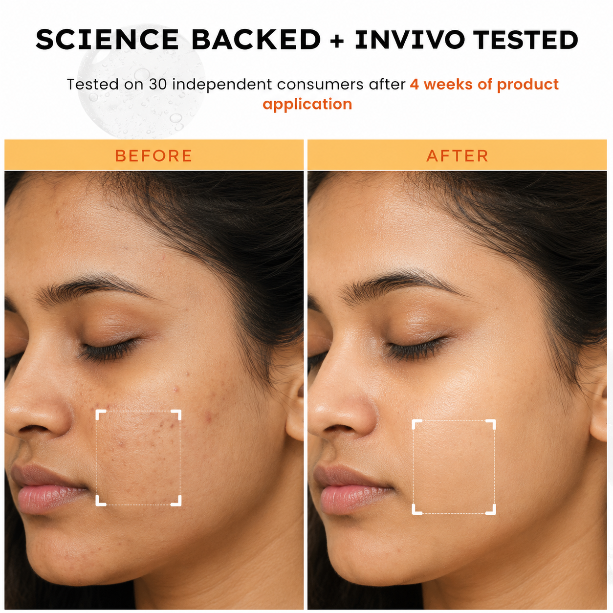 Neem Villa Vitamin C & E Face Serum (30ml)