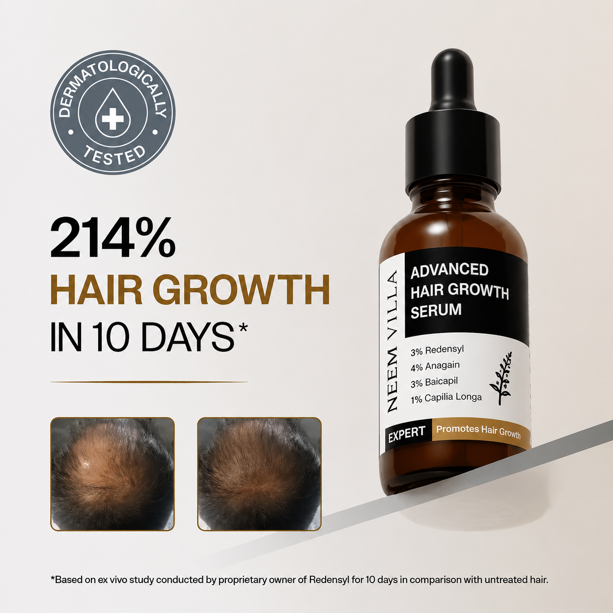 Hair Growth Serum (30 ml), Scalp Massager, Rosemary Oil (100 ml) & Rosemary Hair Spray (200 ml) Combo for Hair Growth
